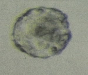 加藤レディスクリニック胚盤胞
